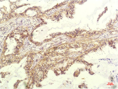 IHC - IL-8 mouse Monoclonal Antibody(14E1) AP63726